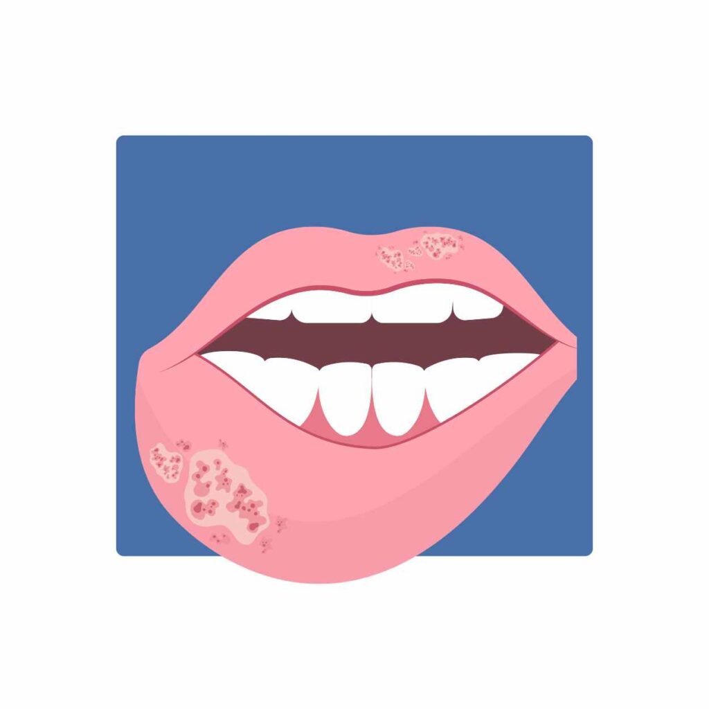 GENGIGEL